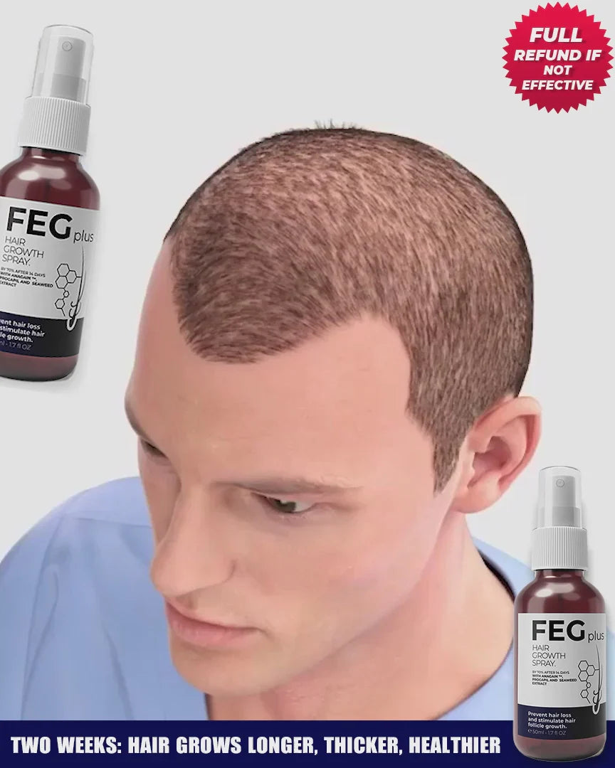 πΏ FEG Plus Hair Growth Spray π§ | π Anti-Hair Loss Treatment for Men & Women π§βπ¦±π©βπ¦° | β‘ Boosts Regrowth & Thickens Hair πͺ | Minoxidil + Herbal Extracts π± | 50ml Bottle