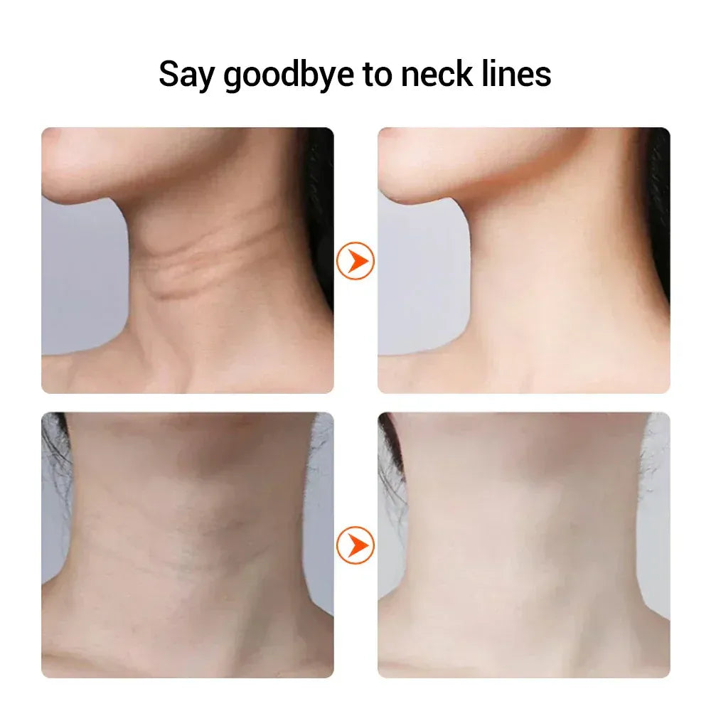 Anti Wrinkle Skin Tightening And Face Lifting Massager