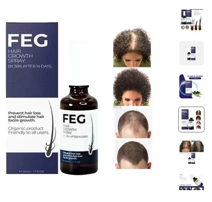 πΏ FEG Plus Hair Growth Spray π§ | π Anti-Hair Loss Treatment for Men & Women π§βπ¦±π©βπ¦° | β‘ Boosts Regrowth & Thickens Hair πͺ | Minoxidil + Herbal Extracts π± | 50ml Bottle